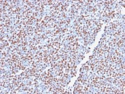 ALK/CD246 Antibody (ALK1/2766R) - Azide and BSA Free, Novus Biologicals 100 &mu;g | Buy Online | Novus Biologicals | Fisher Scientific